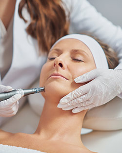 RF Microneedling Near Me in Avon, CT