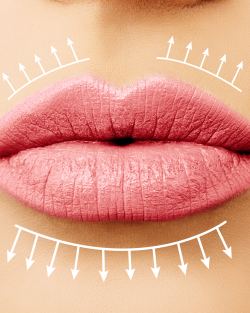 Lip Filler Near Me in Avon, CT Lip Filler Near Me in Avon, CT