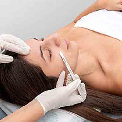 Dermaplaning in Avon, CT