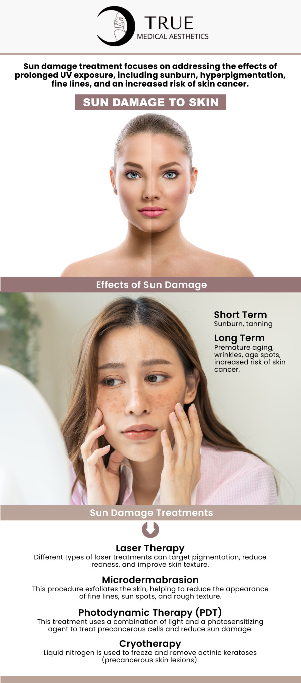 True Medical Aesthetics offers specialized treatments for sun-damaged skin, helping restore your skin’s youthful appearance. Our services, including advanced skincare and rejuvenation therapies, target discoloration, wrinkles, and sunspots, leaving you with smoother, healthier skin. Trust Tristen Durkin, RN to bring back your natural glow. For more information, contact us or request an appointment online. We are conveniently located at 50 Avon Meadow Lane Avon, CT 06001.