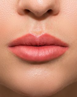 Lip Flip Treatment Near Me in Avon, CT Lip Flip Treatment Near Me in Avon, CT