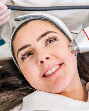 RF Microneedling Near Me in Avon, CT RF Microneedling Near Me in Avon, CT