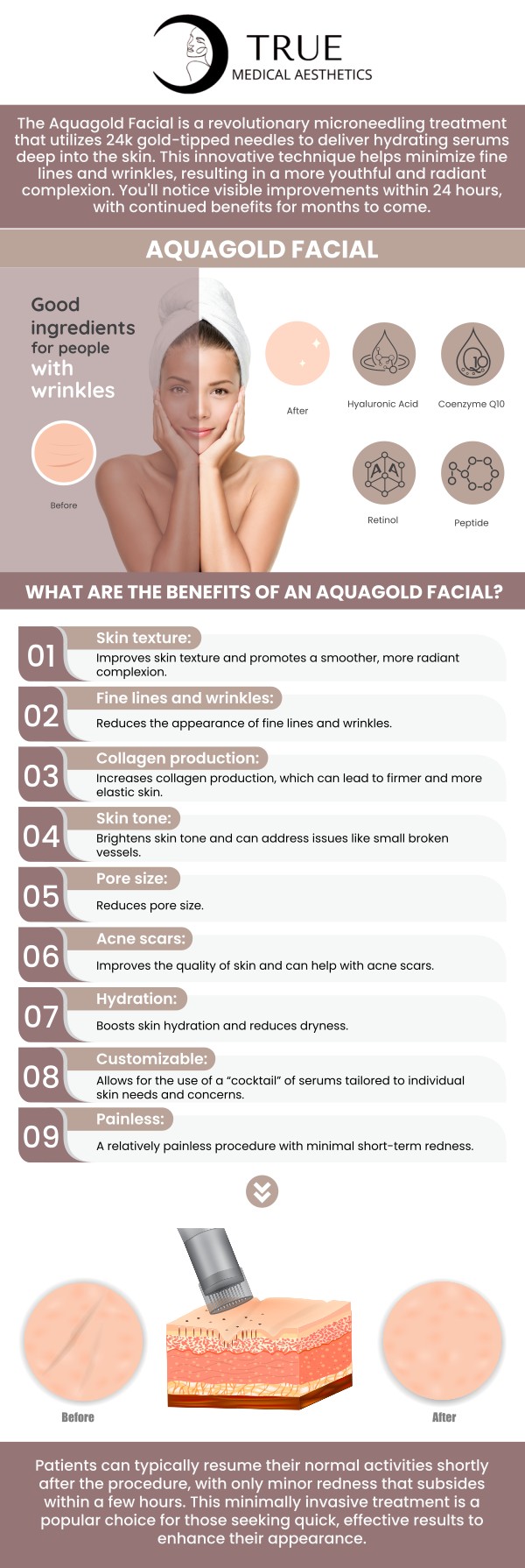 Elevate your skincare experience with our Aquagold Deluxe Facial, an exclusive treatment administered by our skilled skincare professionals, designed to redefine your complexion, leaving it hydrated, radiant, and visibly refreshed. Unveil the radiant glow you deserve with Aquagold, where science meets luxury for a truly transformative and revitalizing journey. For more information, contact us or schedule an appointment online. Our clinic is conveniently located at 50 Avon Meadow Lane Avon, CT 06001. Elevate your skincare experience with our Aquagold Deluxe Facial, an exclusive treatment administered by our skilled skincare professionals, designed to redefine your complexion, leaving it hydrated, radiant, and visibly refreshed. Unveil the radiant glow you deserve with Aquagold, where science meets luxury for a truly transformative and revitalizing journey. For more information, contact us or schedule an appointment online. Our clinic is conveniently located at 50 Avon Meadow Lane Avon, CT 06001.