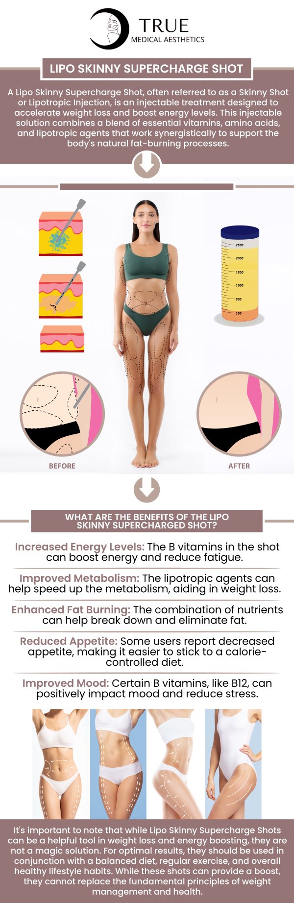 The Lipo Shot is an effective tool for enhancing weight loss by boosting metabolism and energy levels. This injectable treatment, when combined with a healthy lifestyle, can support fat burning and improve overall body composition. At True Medical Aesthetics, Tristen Durkin, RN, provides expert advice on maintaining healthy habits for optimal results. Their guidance ensures the safe and effective use of this treatment, leading to the best possible outcomes. For more information, please contact us or schedule an appointment online. We are conveniently located at 50 Avon Meadow Ln, Avon, CT 06001.