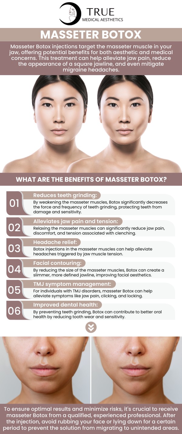 Botox injections for the masseter muscles are a safe and effective way to treat jaw clenching, teeth grinding (bruxism), and TMJ pain. This quick, non-surgical treatment relaxes the muscles, relieving tension and discomfort. As a bonus, it can also create a more slender, V-shaped jawline. For those suffering from jaw pain, teeth grinding, or TMJ symptoms, visit Tristen Durkin, RN and her team for a consultation. For more information, please contact us or schedule an appointment online. We are conveniently located at 50 Avon Meadow Ln, Avon, CT 06001. Botox injections for the masseter muscles are a safe and effective way to treat jaw clenching, teeth grinding (bruxism), and TMJ pain. This quick, non-surgical treatment relaxes the muscles, relieving tension and discomfort. As a bonus, it can also create a more slender, V-shaped jawline. For those suffering from jaw pain, teeth grinding, or TMJ symptoms, visit Tristen Durkin, RN and her team for a consultation. For more information, please contact us or schedule an appointment online. We are conveniently located at 50 Avon Meadow Ln, Avon, CT 06001.