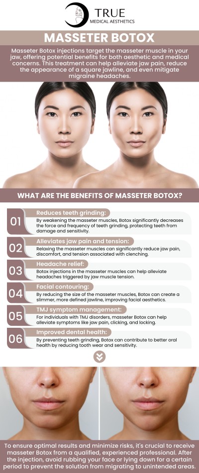 Botox injections for the masseter muscles are a safe and effective way to treat jaw clenching, teeth grinding (bruxism), and TMJ pain. This quick, non-surgical treatment relaxes the muscles, relieving tension and discomfort. As a bonus, it can also create a more slender, V-shaped jawline. For those suffering from jaw pain, teeth grinding, or TMJ symptoms, visit Tristen Durkin, RN and her team for a consultation. For more information, please contact us or schedule an appointment online. We are conveniently located at 50 Avon Meadow Ln, Avon, CT 06001. Botox injections for the masseter muscles are a safe and effective way to treat jaw clenching, teeth grinding (bruxism), and TMJ pain. This quick, non-surgical treatment relaxes the muscles, relieving tension and discomfort. As a bonus, it can also create a more slender, V-shaped jawline. For those suffering from jaw pain, teeth grinding, or TMJ symptoms, visit Tristen Durkin, RN and her team for a consultation. For more information, please contact us or schedule an appointment online. We are conveniently located at 50 Avon Meadow Ln, Avon, CT 06001.