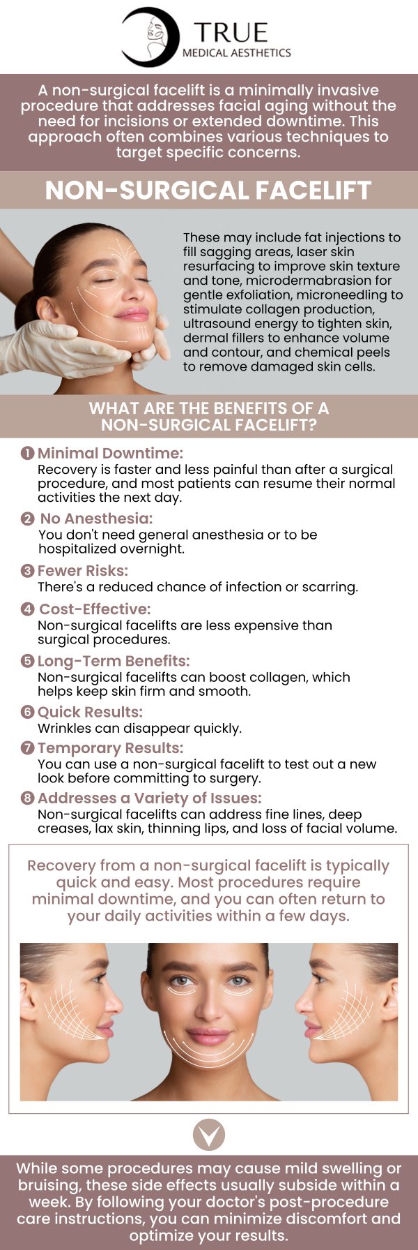 Signs of aging such as sunken cheeks, deep wrinkles, fine lines, skin laxity, acne scars, and loss of facial volume can all be effectively reversed with non-surgical facelifts. Visit Tristen Durkin, RN, and her team at True Medical Aesthetics for non-surgical facelift treatments. We are conveniently located at 50 Avon Meadow Lane Avon, CT 06001. For more information, contact us or request an appointment online.