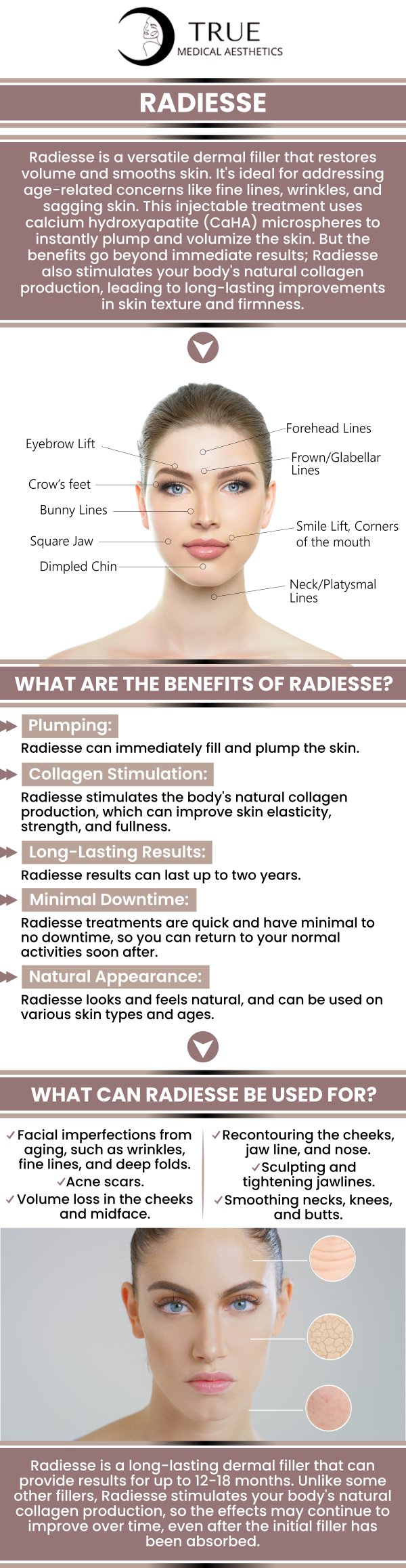 Radiesse is a cosmetic flaw corrector that is frequently used to decrease or correct marionette lines, frown lines, smile lines, and nasolabial folds. To reduce wrinkling, small lines, or deep folds around the lips and cheeks, make a consultation with Tristen Durkin at True Medical Aesthetics. We are conveniently located at 50 Avon Meadow Lane Avon, CT 06001. For more information, contact us or request an appointment online.