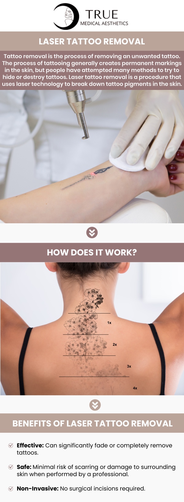 The procedure of removing an unwanted tattoo is referred to as tattoo removal. In most cases, tattooing leaves behind permanent scars on the skin. Permanent ink from tattoos can be removed from the skin using lasers, surgery, or cosmetic procedures. At True Medical Aesthetics, Tristen Durkin, RN, and her team provide laser tattoo removal, a cutting-edge, minimally invasive technique to fade and remove undesirable tattoos. For more information, please contact us or schedule an appointment online. We are conveniently located at 50 Avon Meadow Ln Avon, CT 06001.