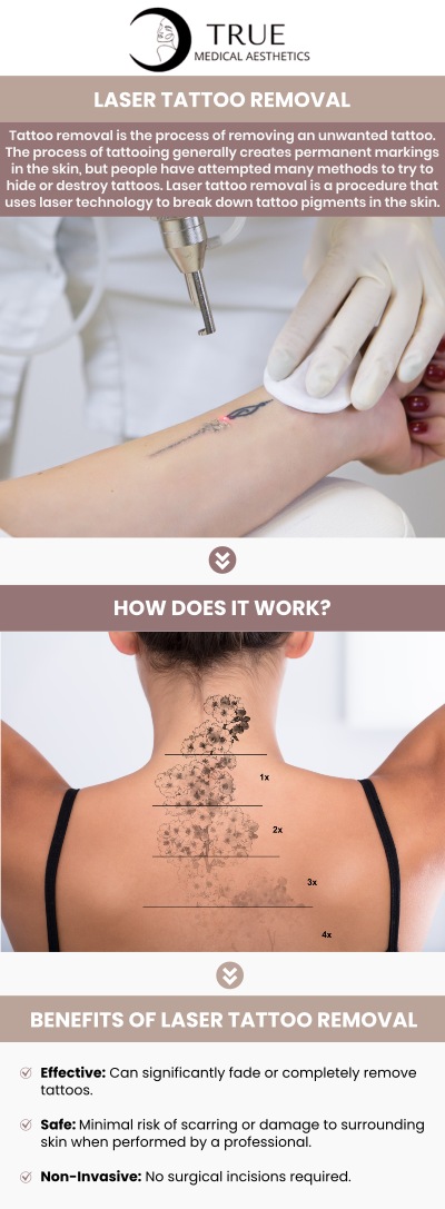 The procedure of removing an unwanted tattoo is referred to as tattoo removal. In most cases, tattooing leaves behind permanent scars on the skin. Permanent ink from tattoos can be removed from the skin using lasers, surgery, or cosmetic procedures. At True Medical Aesthetics, Tristen Durkin, RN, and her team provide laser tattoo removal, a cutting-edge, minimally invasive technique to fade and remove undesirable tattoos. For more information, please contact us or schedule an appointment online. We are conveniently located at 50 Avon Meadow Ln Avon, CT 06001.